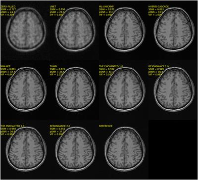 Multi-Coil MRI Reconstruction Challenge—Assessing Brain MRI Reconstruction Models and Their Generalizability to Varying Coil Configurations